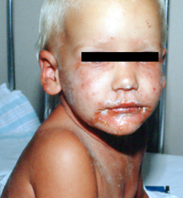 A child with a black stripeDescription automatically generated with medium confidence