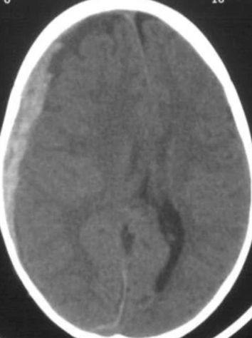 A close-up of a brainDescription automatically generated