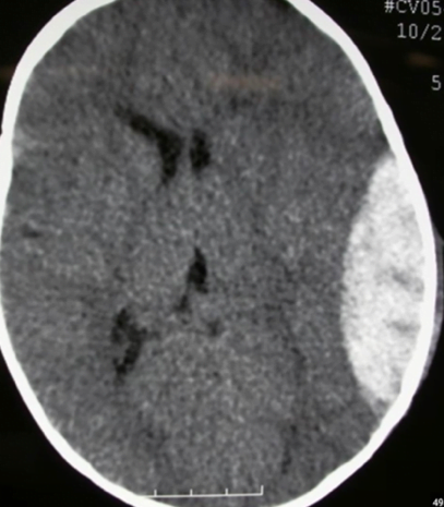A close-up of a brain scanDescription automatically generated