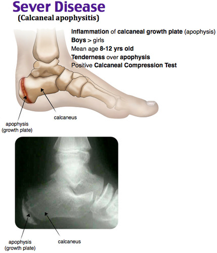 A close-up of a footDescription automatically generated