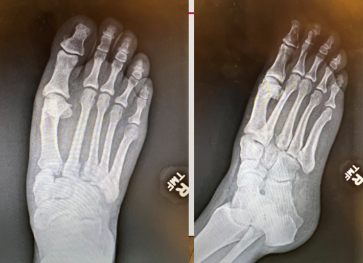 A close up of a footDescription automatically generated