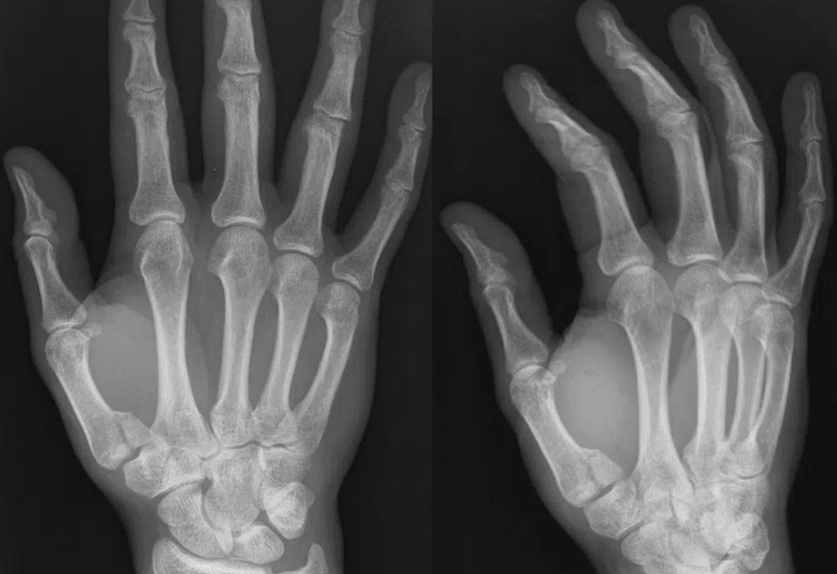 A close-up of a handDescription automatically generated