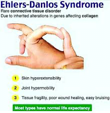 A close-up of a handDescription automatically generated