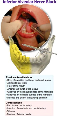 A close-up of a human jawDescription automatically generated