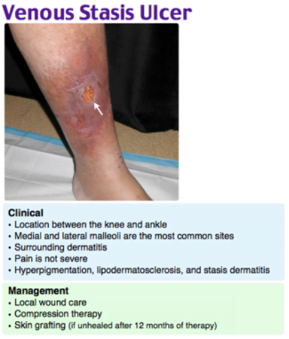 A close-up of a leg with a bruiseDescription automatically generated