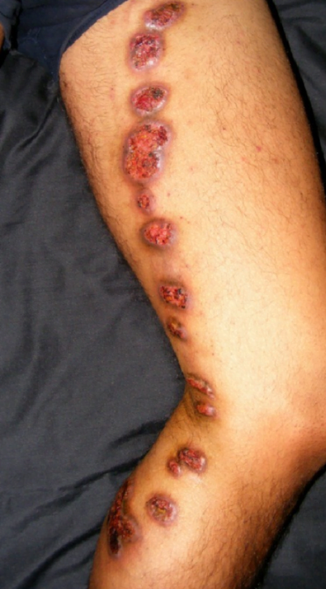 A close-up of a leg with a few bumpsDescription automatically generated