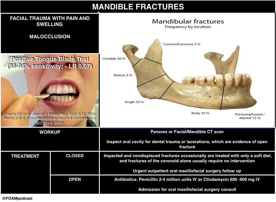 A close-up of a mandibular fracturesDescription automatically generated