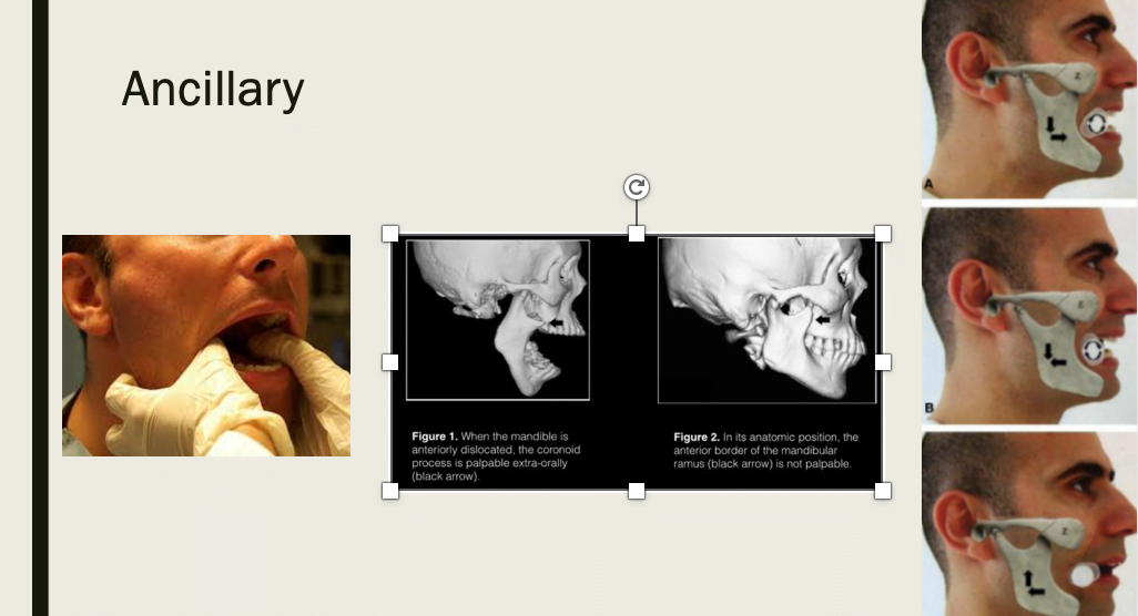 A close-up of a skullDescription automatically generated