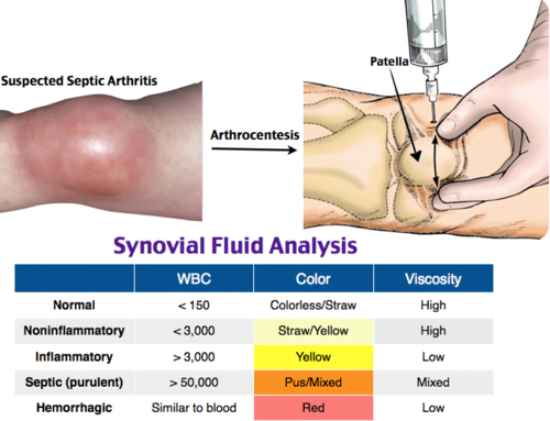 A close-up of a syringeDescription automatically generated