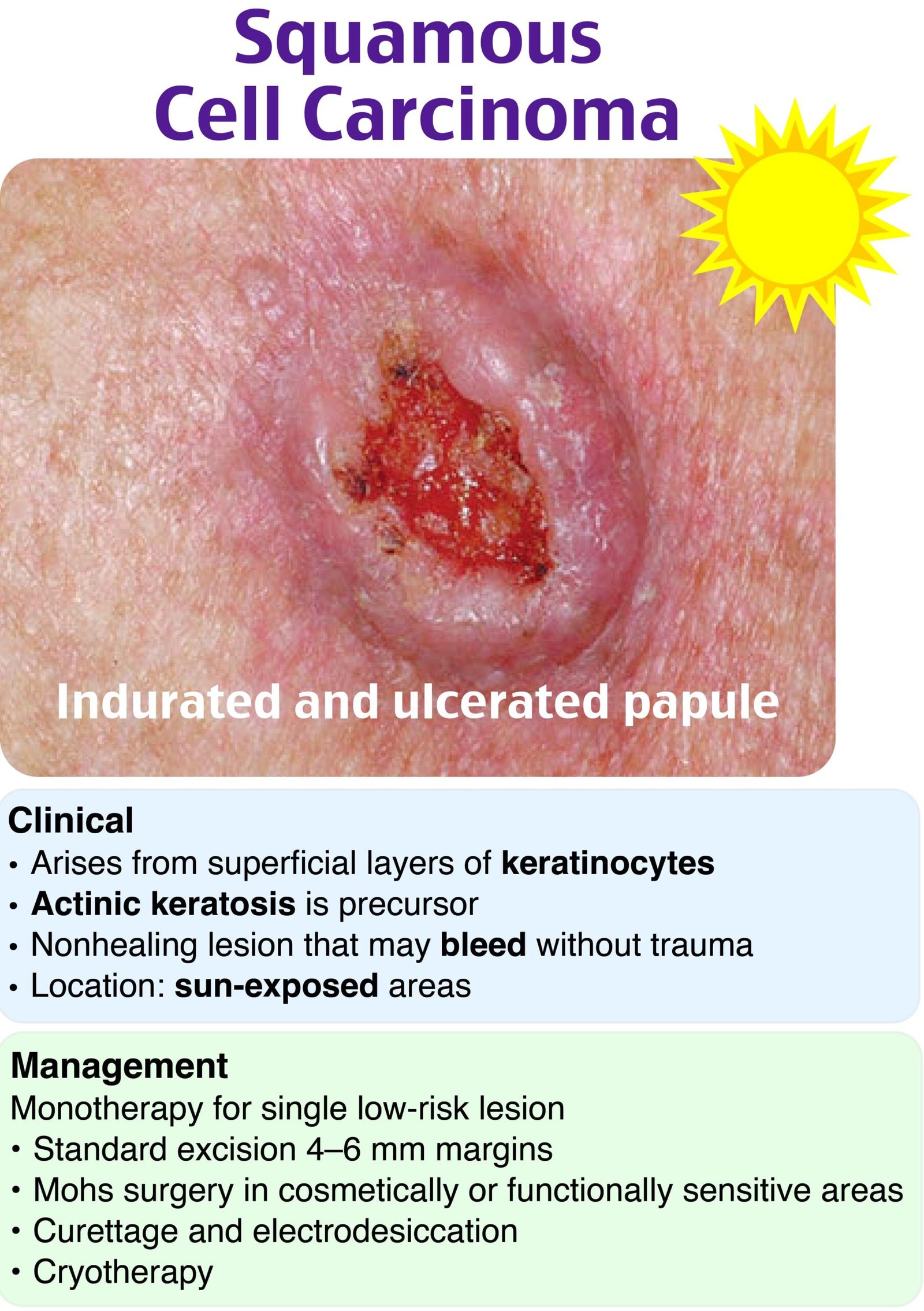 A close-up of a woundDescription automatically generated