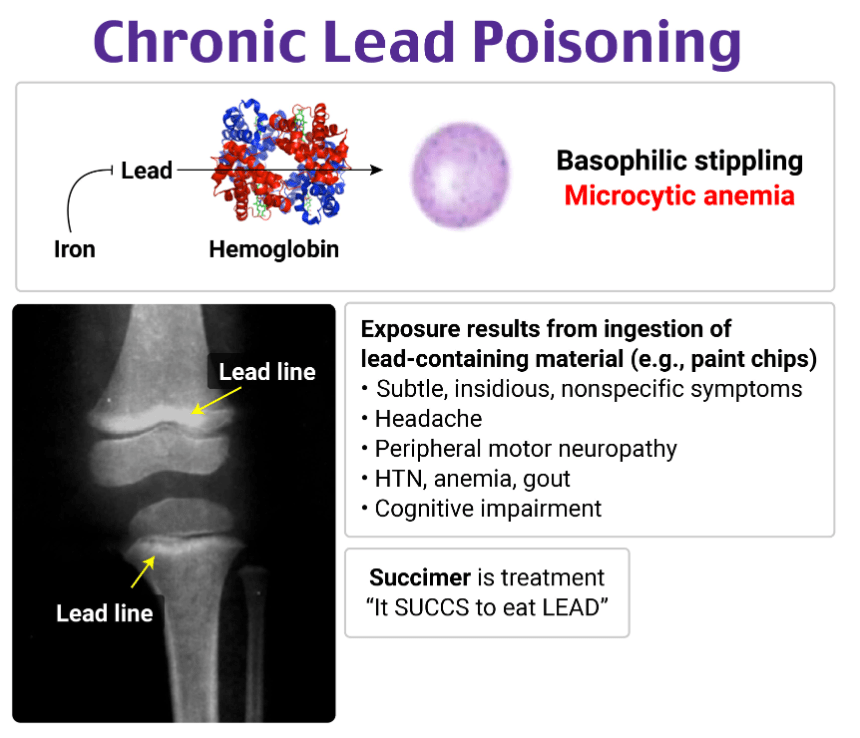 A close-up of a x-rayDescription automatically generated