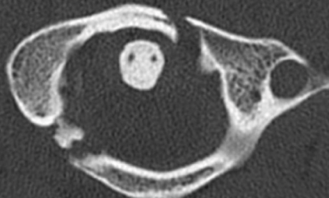 A close-up of an x-rayDescription automatically generated