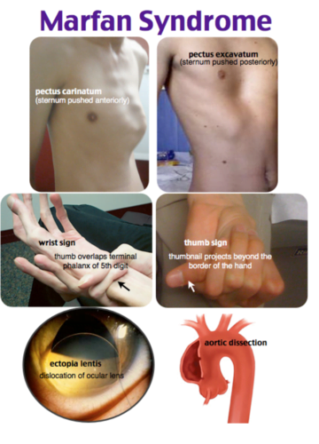 A close-up of several different types of human body partsDescription automatically generated
