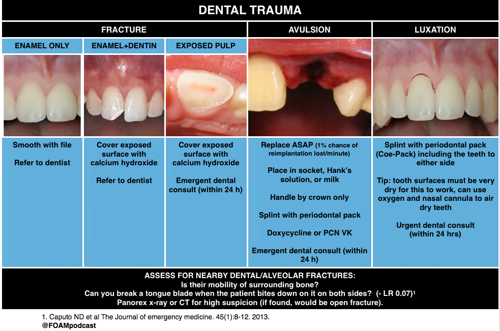 A comparison of teeth and gumsDescription automatically generated