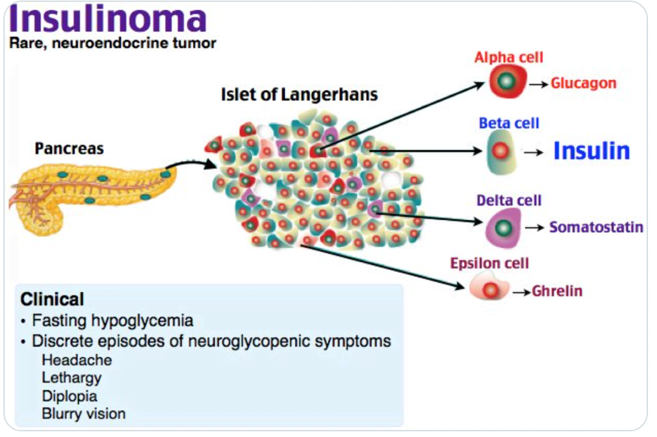 A diagram of a cancer cellDescription automatically generated