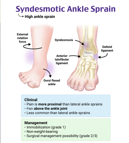 A diagram of a foot and ankle sprainDescription automatically generated