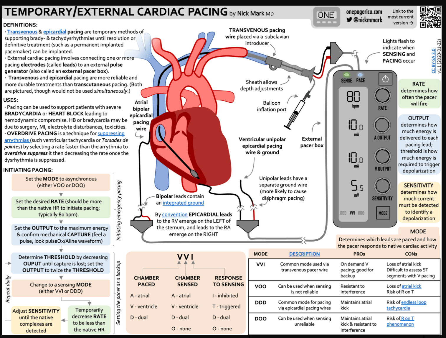 A diagram of a heartDescription automatically generated