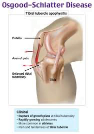 A diagram of a human bodyDescription automatically generated