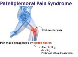 A diagram of a human kneeDescription automatically generated
