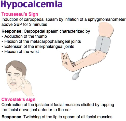 A diagram of a person's handDescription automatically generated
