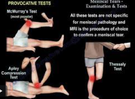 A diagram of a person's kneeDescription automatically generated