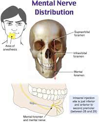 A diagram of a skullDescription automatically generated