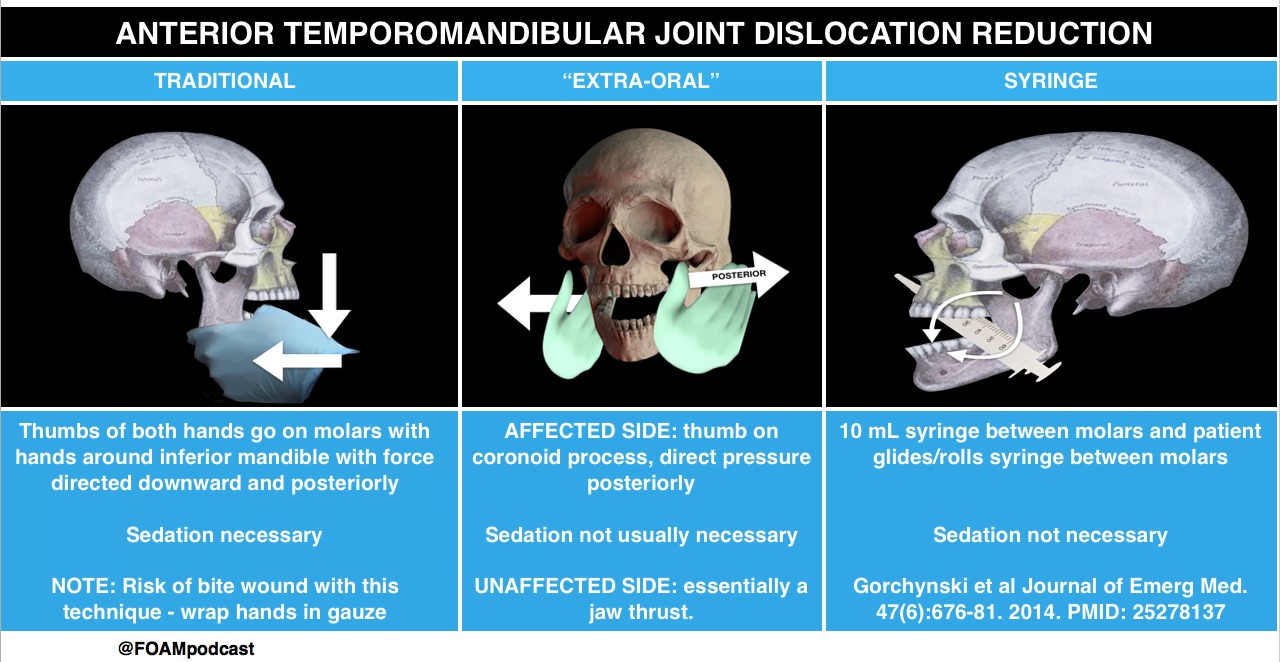 A diagram of a skullDescription automatically generated