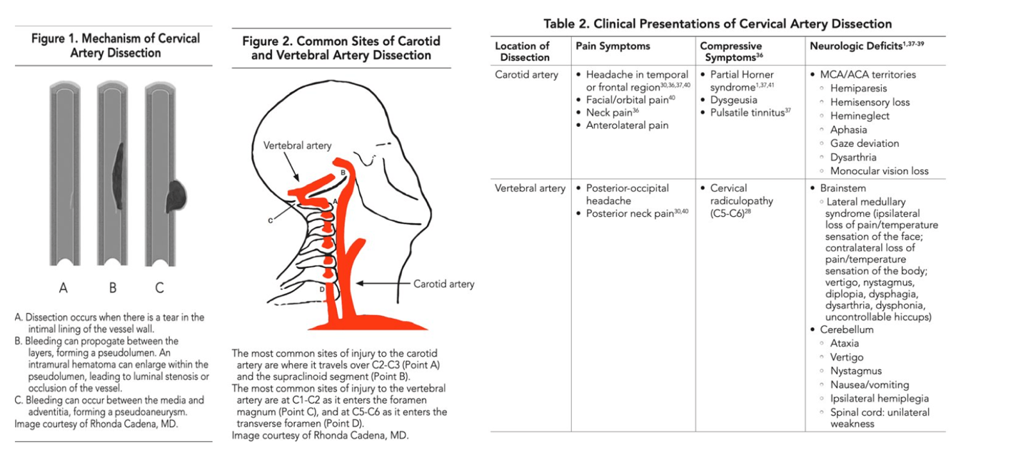 A diagram of the neck and backDescription automatically generated