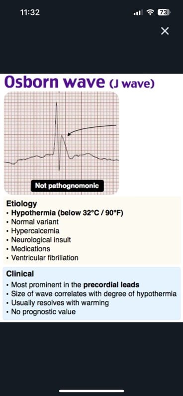 A graph with a graph on itDescription automatically generated