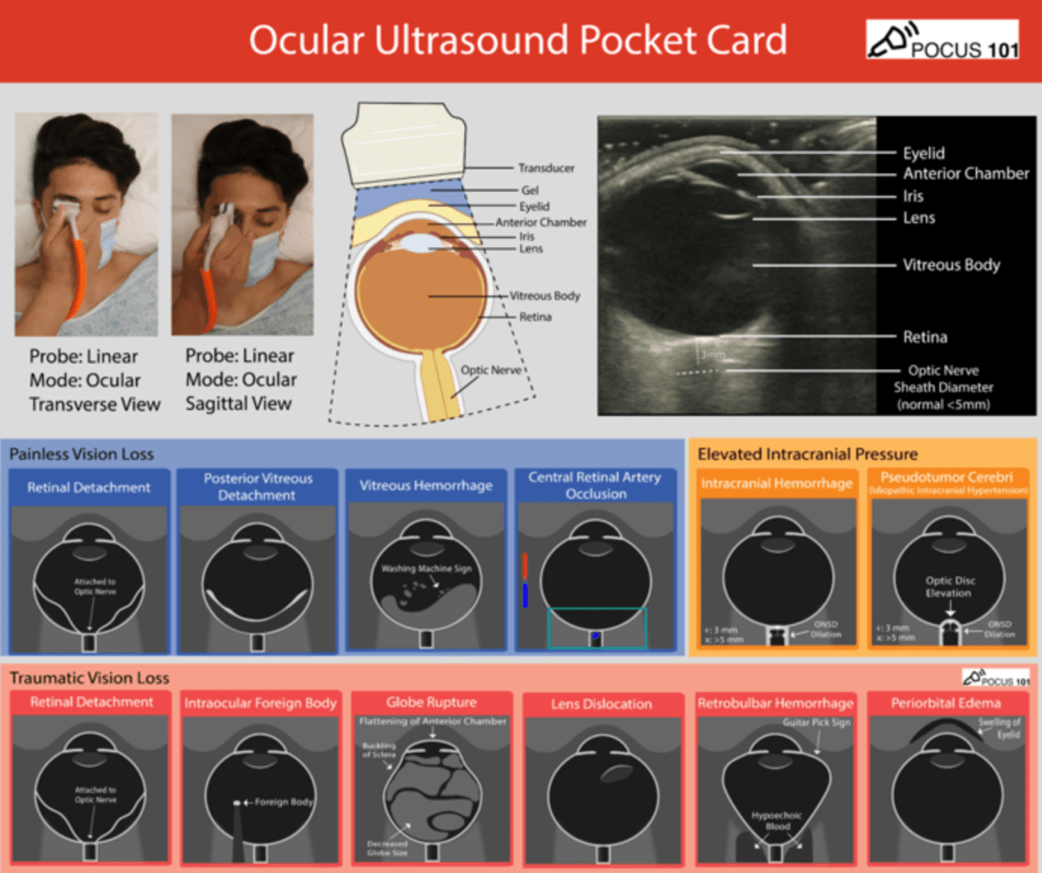 A medical chart showing ultrasoundDescription automatically generated with medium confidence