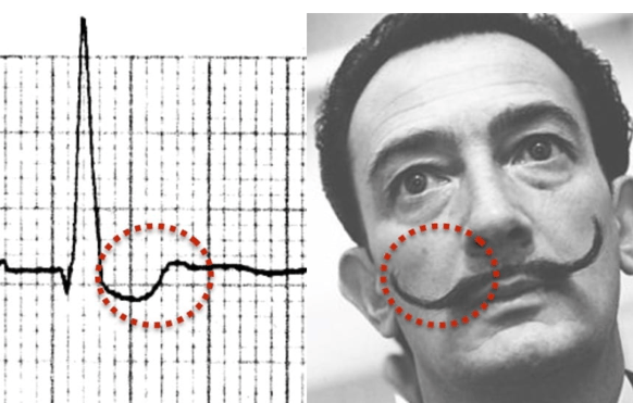 A person with a mustache drawn on his noseDescription automatically generated