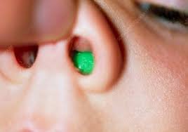 A person's nose with a green earplugDescription automatically generated