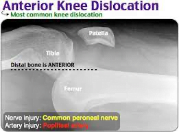 A x-ray of a human footDescription automatically generated