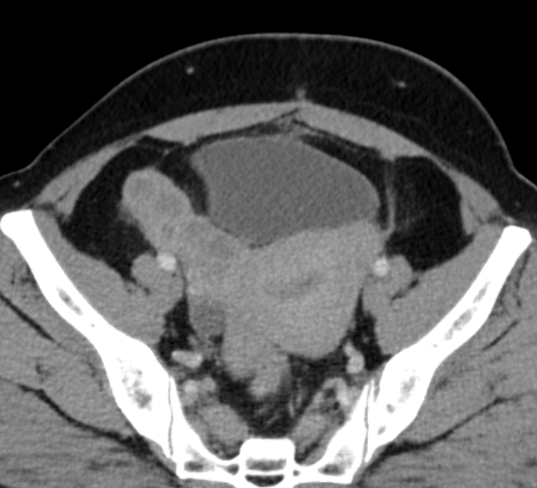 An x-ray of a person's bodyDescription automatically generated