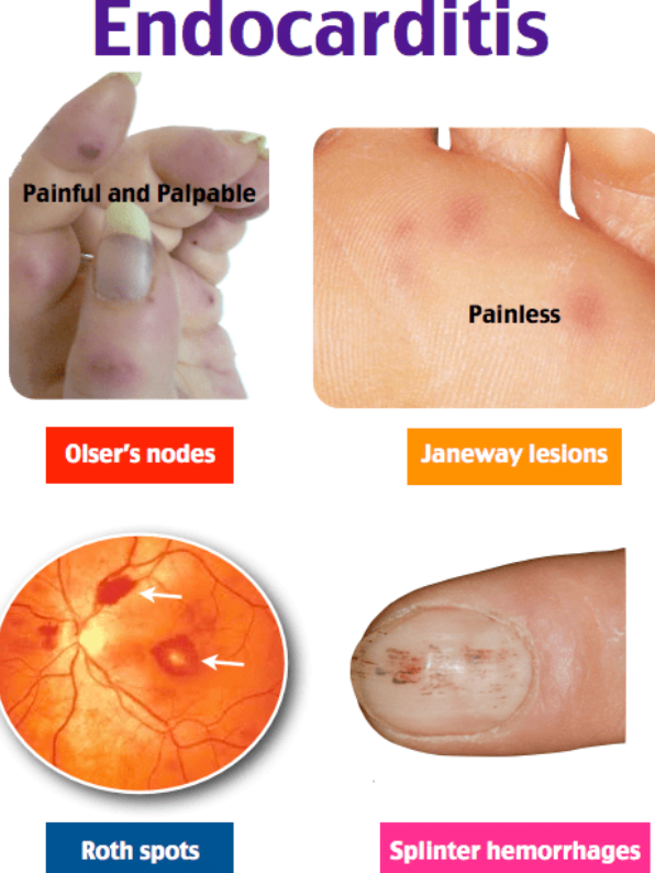 Close-up of a person's handDescription automatically generated