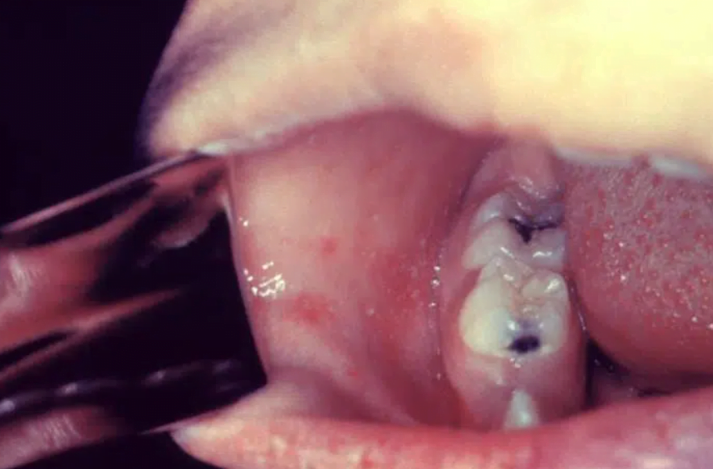 Close up of a person's mouthDescription automatically generated