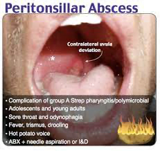 Close-up of a person's mouth with tongue and textDescription automatically generated