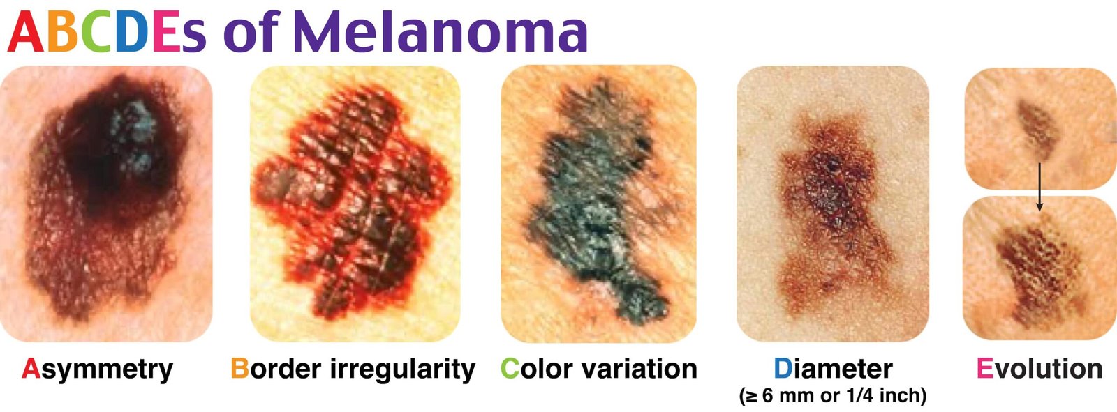 Several skin diseases with different colorsDescription automatically generated with medium confidence
